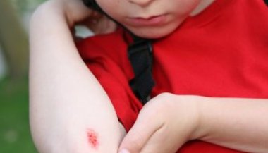 Sonhar com sangue em outra pessoa