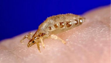 Sonhar com piolho vivo