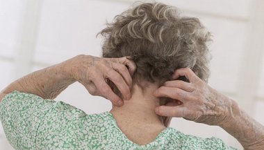 Sonhar com piolho na cabeça