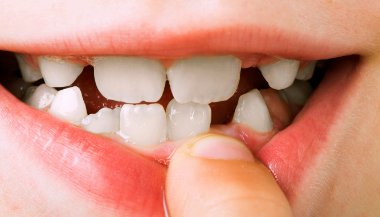 Sonhar com dente nascendo