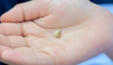 Significado de sonhar com dente caindo da boca