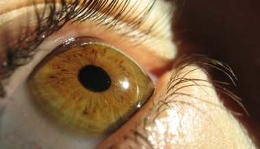 O que é iridologia?