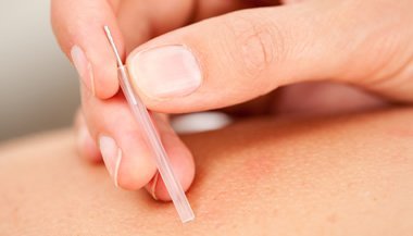 Acupuntura é cada vez mais indicada no tratamento da doença de Parkinson