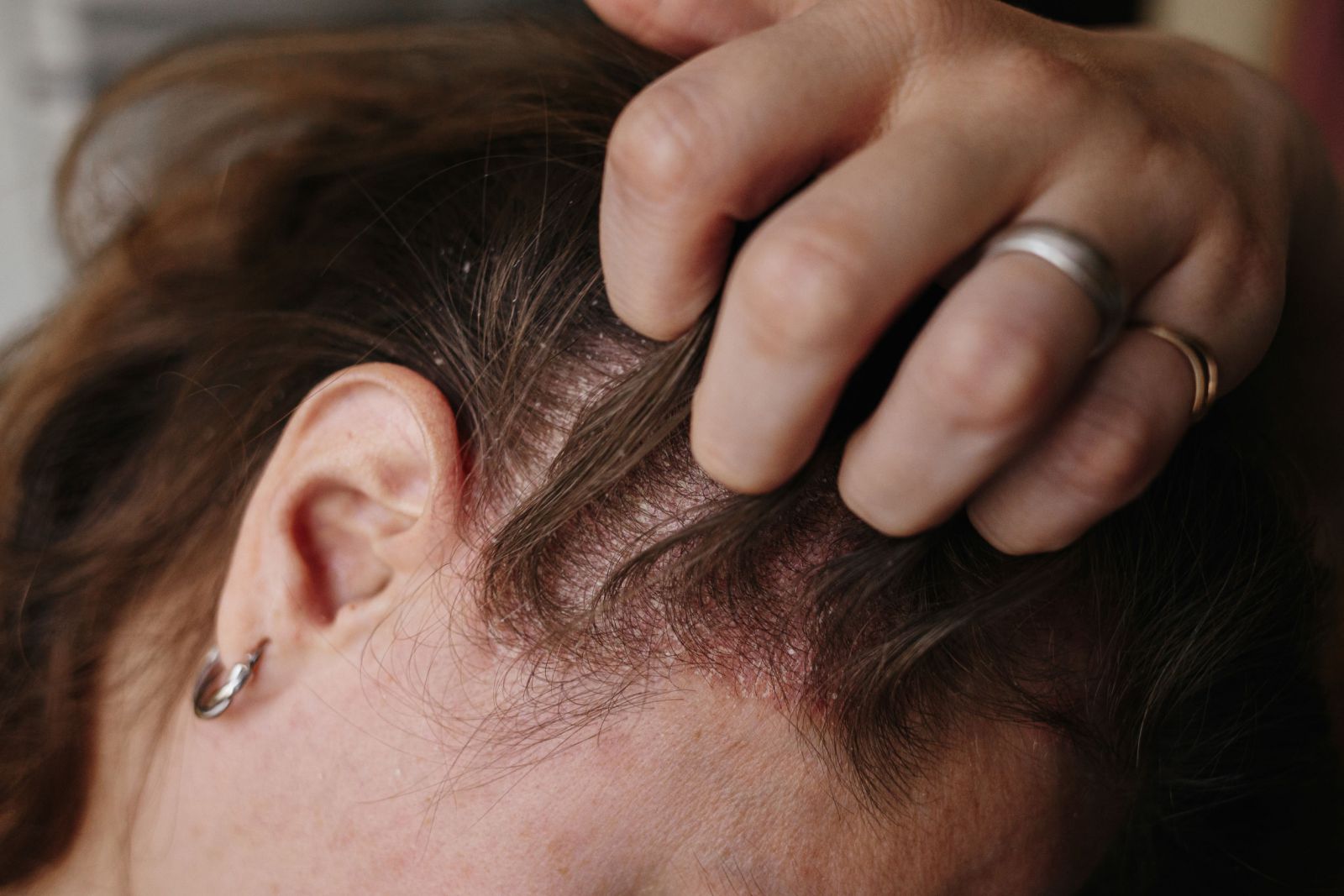 Mulher coçando sua cabeça