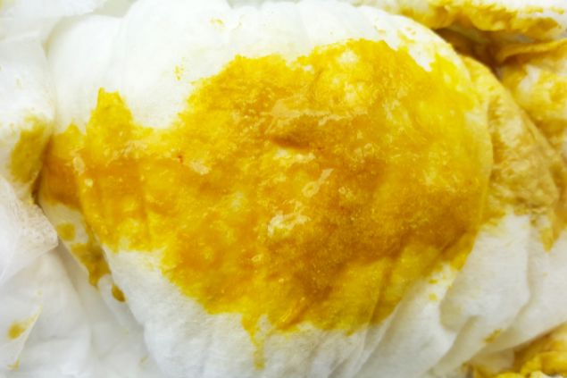 Imagem de uma fralda com fezes de bebê