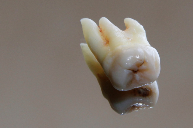 Dente podre com um pouco de sangue